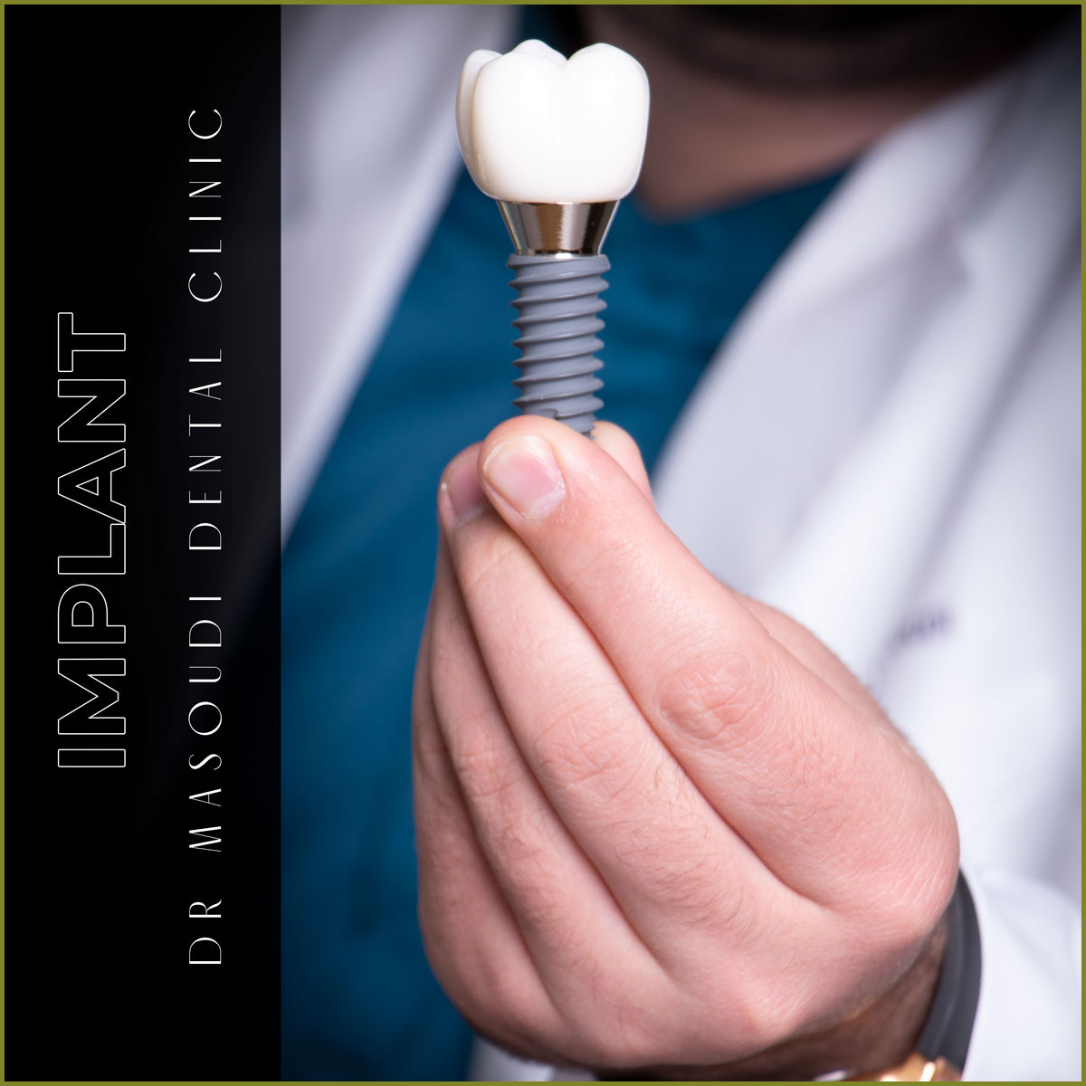 ایمپلنت دندان در کرج. ایمپلنت دندان در واقع یک پایه از جنس تیتانیوم است که شبیه به ریشه دندان بوده و با کمک جراحی، وارد استخوان فک در زیر لثه می‌‌شود.