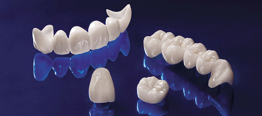 کلینیک دندانپزشکی دکتر مسعودی انواع روکش دندان
