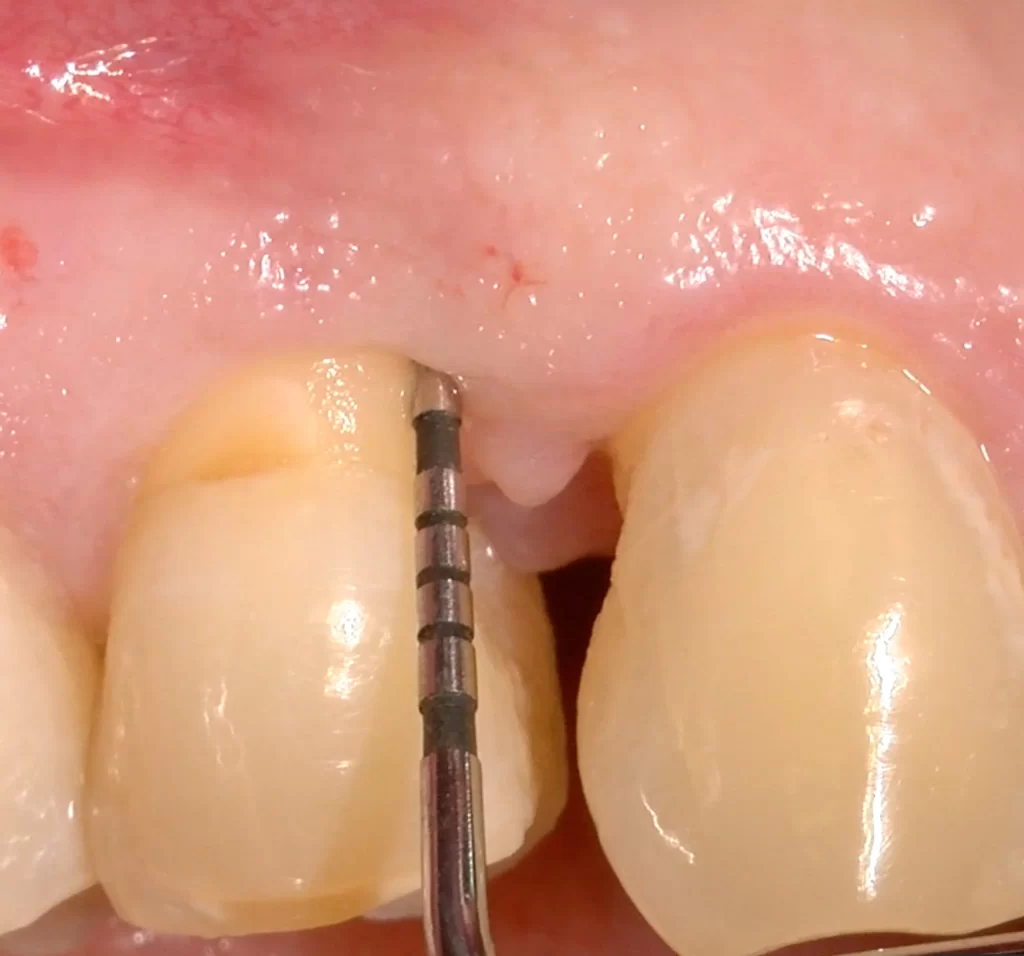 کلینیک دندانپزشکی دکتر مسعودی نسج دندان