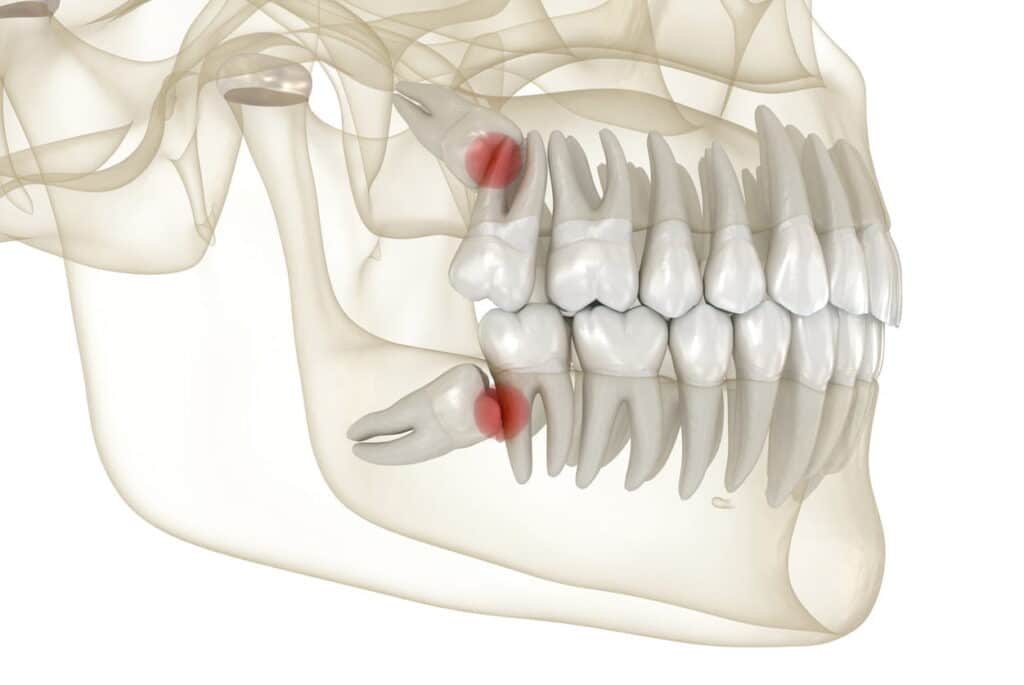 چرا دندان عقل داریم ؟