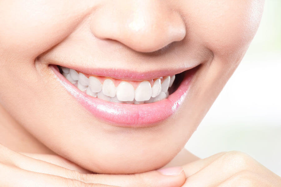 بلیچینگ دندان: لبخندی درخشان با دندان های سفید