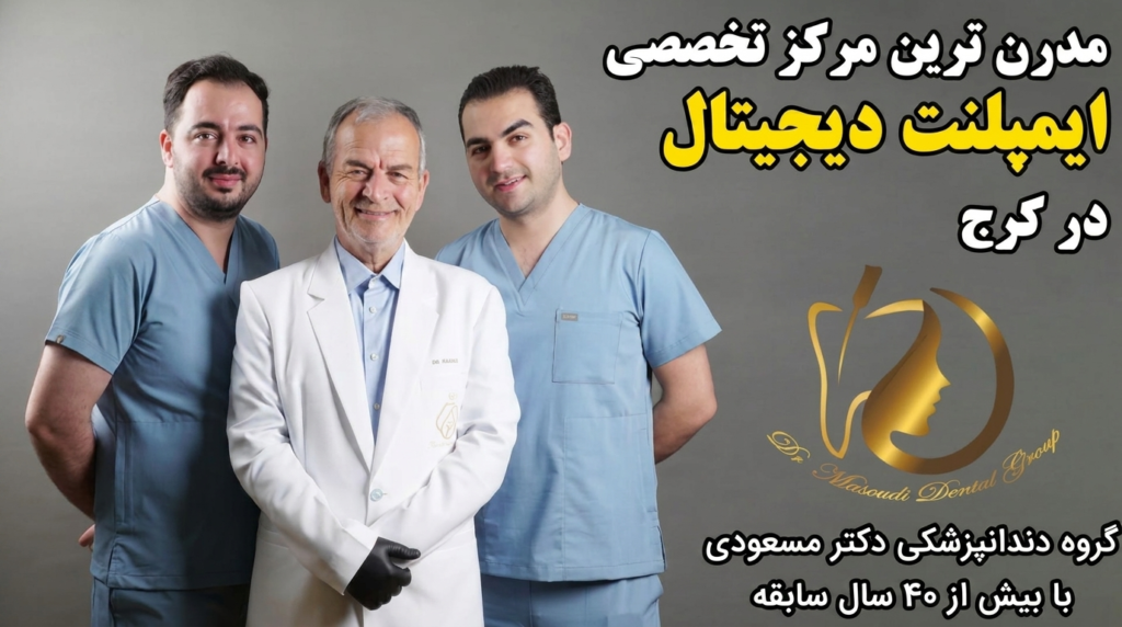 ایمپلنت کرج