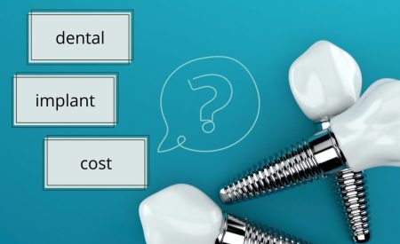 علت تفاوت هزینه ایمپلنت دندان در کرج