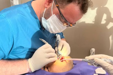 کشیدن دندان عقل در کرج دکتر مسعودی